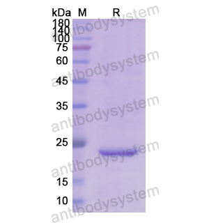 Recombinant Human RBP4, N-His