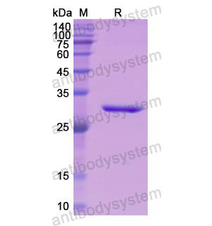 Recombinant Human AHSG, N-His