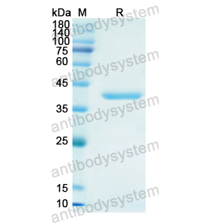 Recombinant Human AFP, N-His