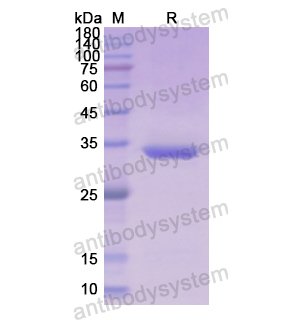 Recombinant Human PF4/CXCL4, N-GST