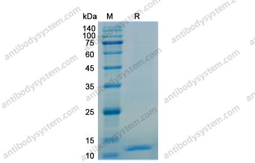 Recombinant Human CXCL10/IP-10, N-His