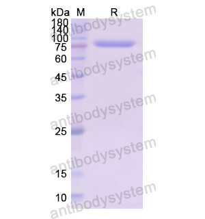 Recombinant Human LTF Protein, N-His