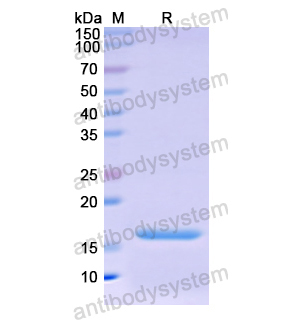 Recombinant Human Osteocalcin/BGLAP/OC, N-His