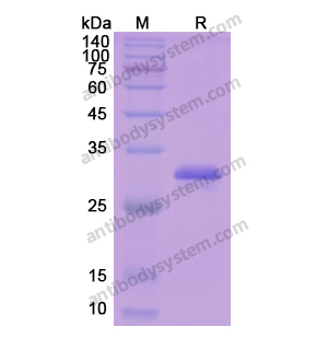 Recombinant Human ESR1/ER-alpha, N-His