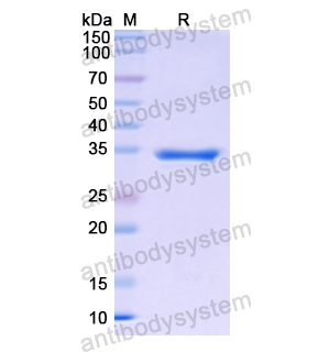 Recombinant Human KLKB1, N-His