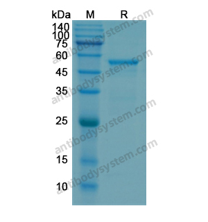 Recombinant Human MMP1, N-His