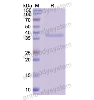 Recombinant Human SLPI, N-GST