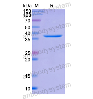 Recombinant Human C4BPA, N-His