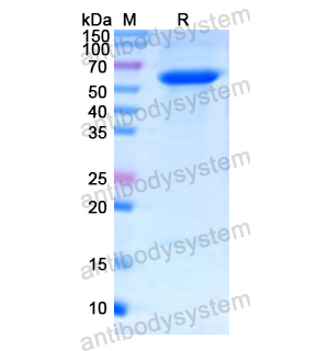 Recombinant Human HMGCR, N-SUMO