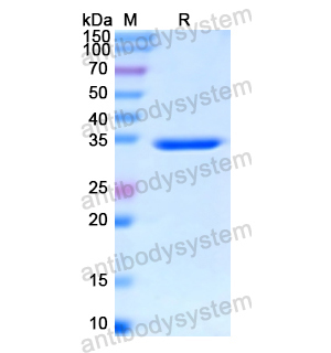 Recombinant Human RAF1, N-His