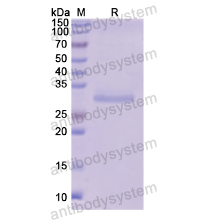 Recombinant Human FUCA1, N-His