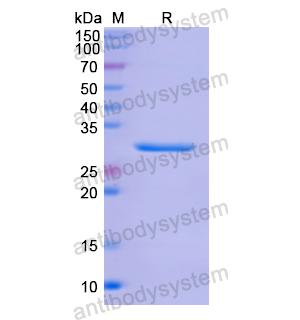 Recombinant Human ALDOA, N-His
