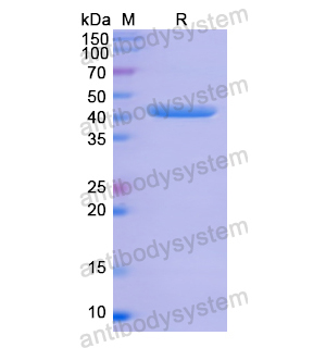 Recombinant Human ANXA1, N-His