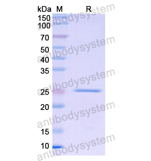 Recombinant Human APOB, N-His