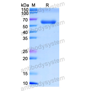 Recombinant Human NR3C1, N-His