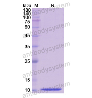 Recombinant Human TFF1, N-His