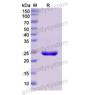 Recombinant Human CD230/PRNP, N-His