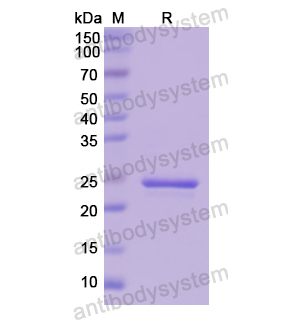 Recombinant Human SOD2, N-His