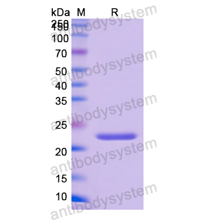 Recombinant Human A1BG, N-His