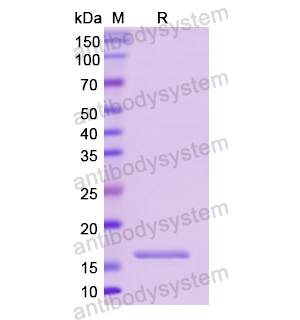 Recombinant Human CD74, N-His