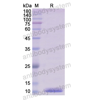 Recombinant Human CD3D, N-His