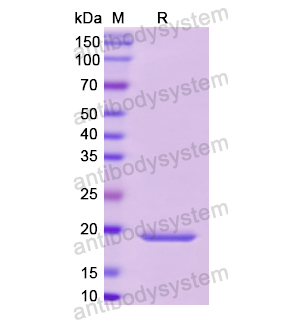 Recombinant Human SHBG, N-His