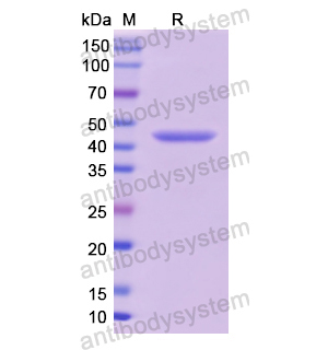 Recombinant Human TP53/p53, N-His