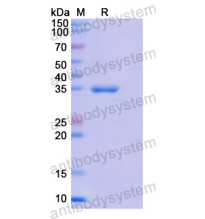 Recombinant Human TYMS, N-His