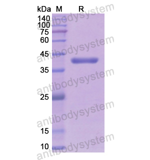 Recombinant Human ALDOB, N-His