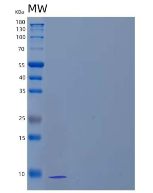 Recombinant Human cAMP-dependent Protein Kinase Inhibitor β/PKI-β Protein(N-6His)