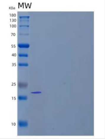 Recombinant Human Fibroblast Growth Factor 7/FGF-7/KGF Protein(C-6His)