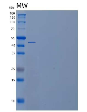 Recombinant Human Selenophosphate Synthase 1/SEPHS1 Protein(C-6His)