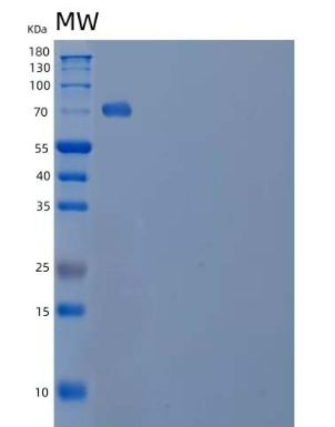 Recombinant Human Semaphorin-4B/SEMA4B Protein(C-6His)