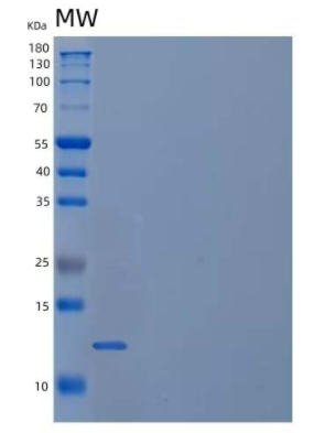 Recombinant Human Follitropin Subunit β/FSHB Protein(C-6His)