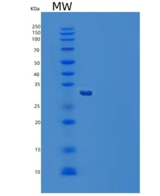 Recombinant Human M-CSF/CSF1 Protein(C-6His)