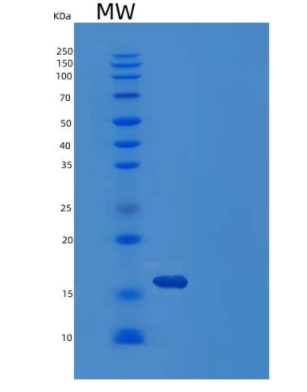 Recombinant Human Galectin-1/LGALS1 Protein(C-6His)