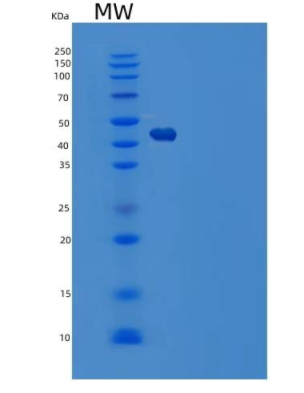 Recombinant Human Serpin H1 Protein(C-6His)