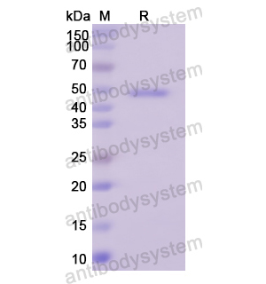 Recombinant Human SERPINB2, N-His