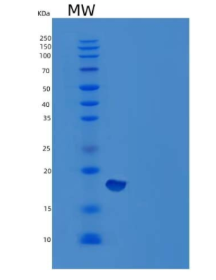 Recombinant Human Glial Fibrillary Acidic Protein/GFAP Protein(N-6His)