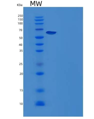 Recombinant Human Glucose-6-Phosphate 1-Dehydrogenase/G6PD Protein(C-6His)