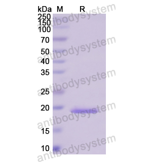 Recombinant Human PCCA, N-His