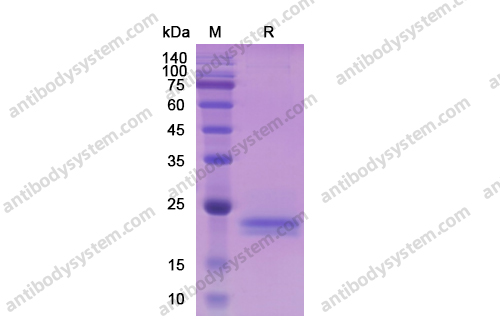 Recombinant Human IL6, C-His