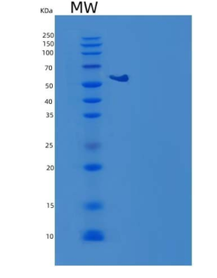 Recombinant Mouse Coagulation Factor X/F10 Protein(C-6His)