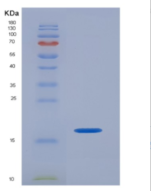 Recombinant Human ISG15 / G1P2 Protein