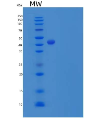 Recombinant Human IL17B / IL-17B Protein (Fc Tag)