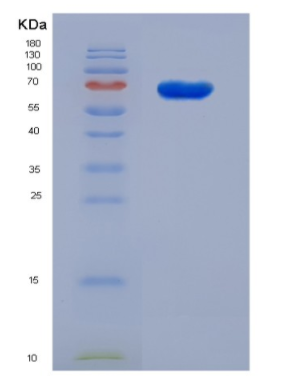 Recobinant Mouse IGFBP-2 / IGFBP2 Protein (Fc Tag)