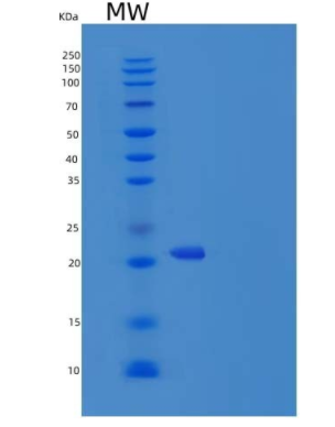 Recombinant Human TNFSF14 / LIGHT / CD258 Protein (His tag)