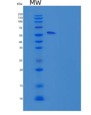 Recombinant Rat ICAM-1 / CD54 Protein (His tag)