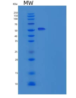 Recombinant Human IL12RB1 Protein (His Tag)