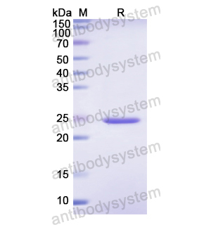 Recombinant Human SSB, N-His